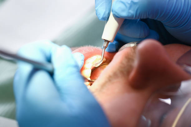 Best Emergency Cosmetic Dentistry (e.g., broken veneers) in Bull Shoals, AR