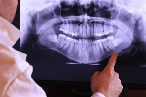 Best Emergency Root Canal Therapy in Bull Shoals, AR