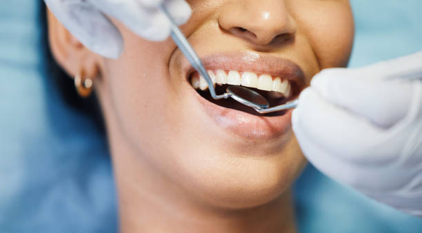 Best Dental Abscess Treatment in Bull Shoals, AR