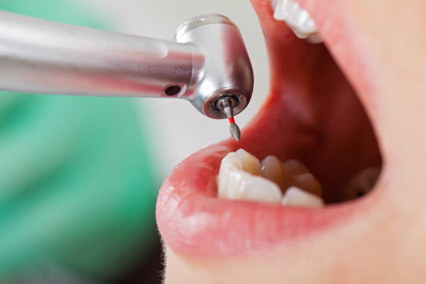 Best Urgent Dental Care for Toothaches in Bull Shoals, AR